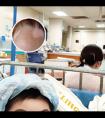 小孩脸上有一块块的白斑是怎么回事